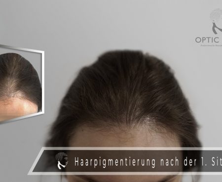 Haarpigmentierung bei Frauen: Sieg über lichtes Haar