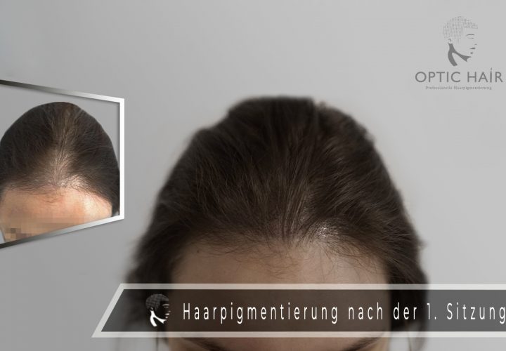 Haarpigmentierung bei Frauen: Sieg über lichtes Haar